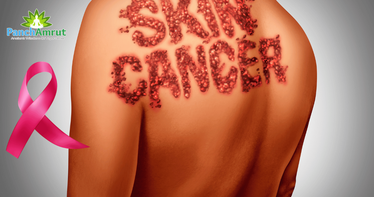 Skin Cancer Treatment